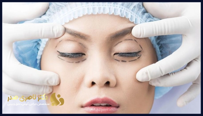 چرا رعایت آمادگی‌های لازم قبل از جراحی بلفاروپلاستی اهمیت دارد؟