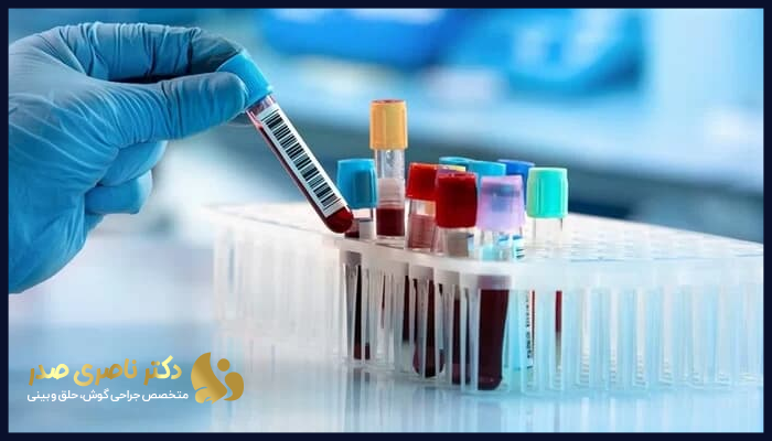 اهمیت آزمایشات قبل از جراحی بینی