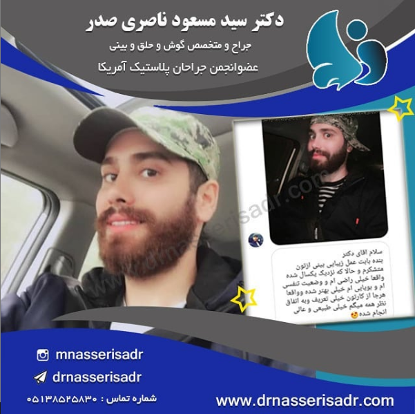 نمونه عمل بینی طبیعی و پسرانه توسط دکتر ناصری صدر