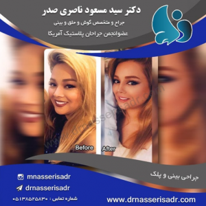 نمونه جراحی بینی توسط دکتر مسعود ناصری صدر