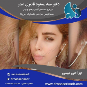نمونه جراحی بینی توسط دکتر مسعود ناصری صدر
