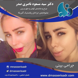 نمونه جراحی بینی استخوانی
