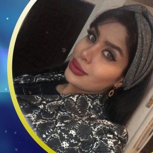 جراحی بینی فانتزی در خانم جوان