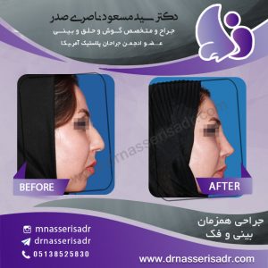جراحی بینی و فک - دکتر مسعود ناصری صدر