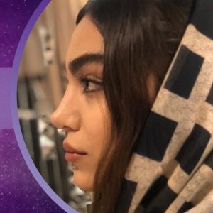تصویر بعد از رینوپلاستی