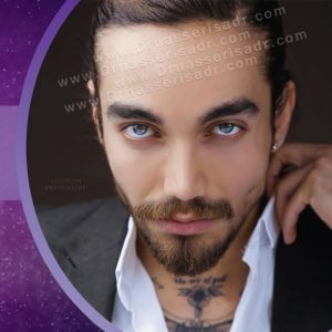 نمونه جراحی بینی مردانه توسط دکتر ناصری صدر
