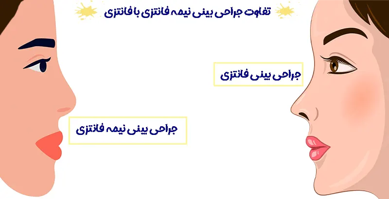 تفاوت جراحی بینی نیمه فانتزی با فانتزی