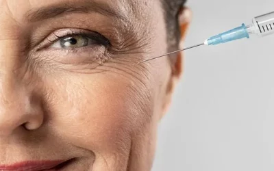 تزریق فیلر زیر چشم