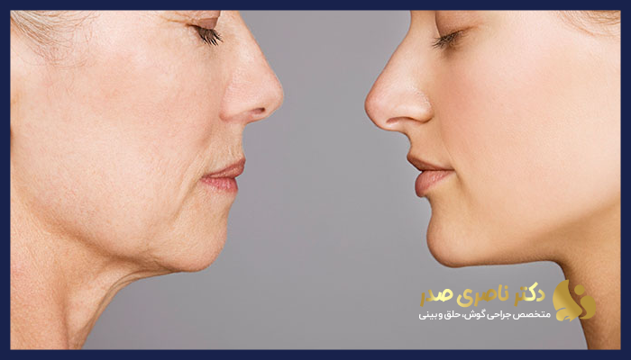 بهترین سن برای عمل بینی چه زمانی است؟ 
