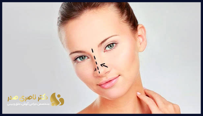 جراحی بینی در افراد دیابتی 