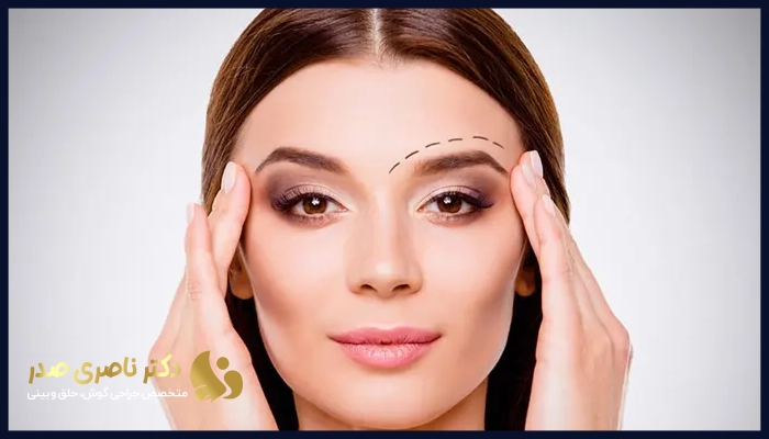 مزایای لیفت اندوسکوپیک ابرو 
