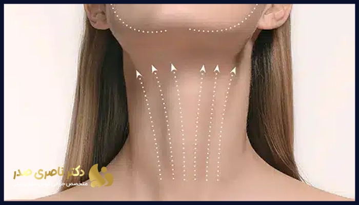 جراحی لیفت گردن چه مزایای دارد؟