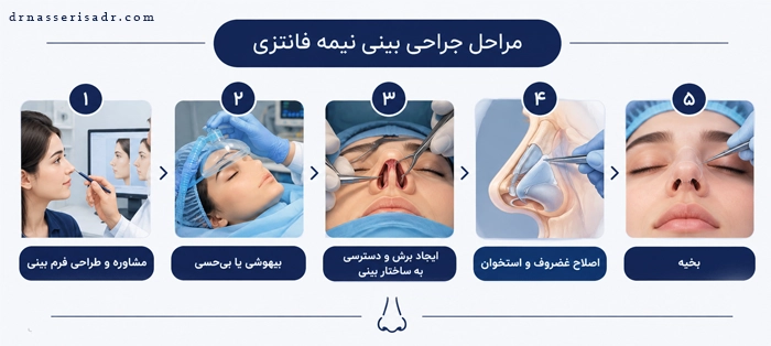 نحوه انجام جراحی بینی نیمه فانتزی